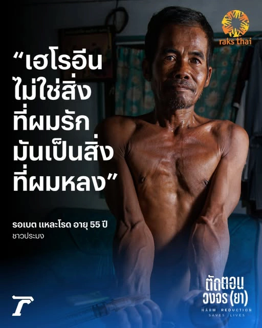 เรื่องราวของรอเบต แหละโรด